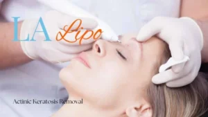 Woman receiving Actinic Keratosis Removal Treatment West Brompton