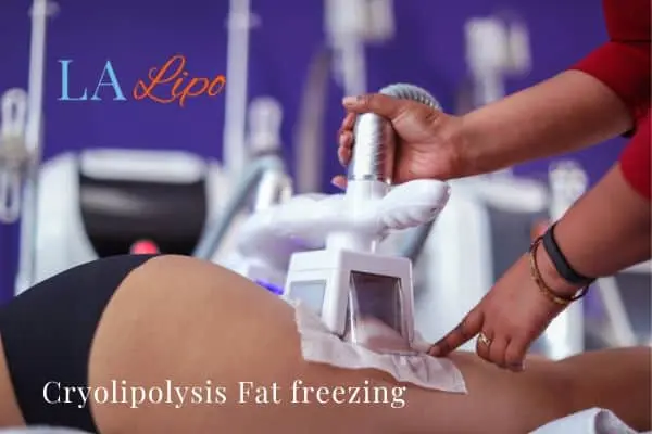 women getting fat freezing West Brompton