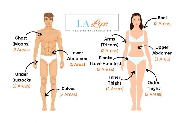 LA LIPO Cryolipolysis Areas West Brompton
