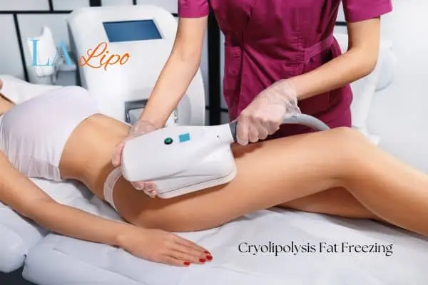Woman receiving coolsculpting West Brompton treatment on her thighs