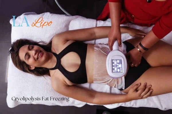 woman getting cryolipolysis West Brompton