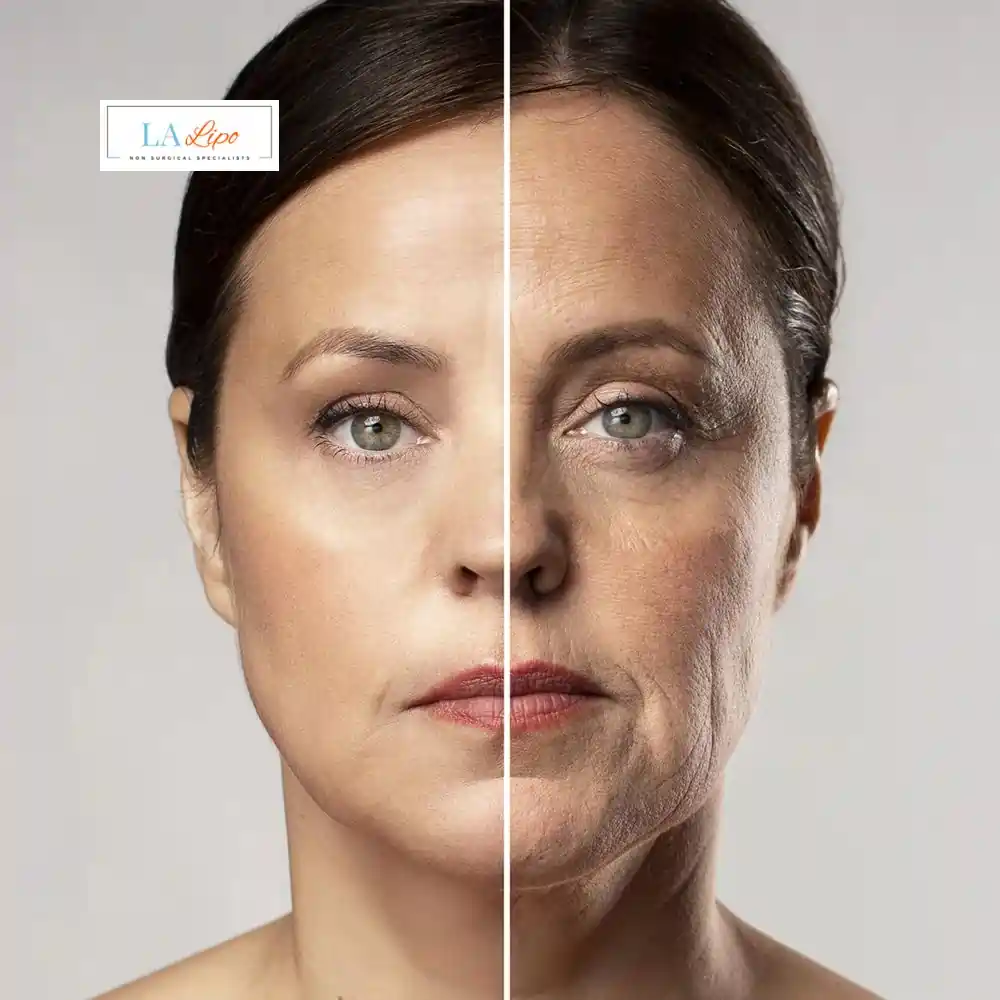 How Can You Tell If Non-Surgical Skin Tightening Is Right for You West Brompton?