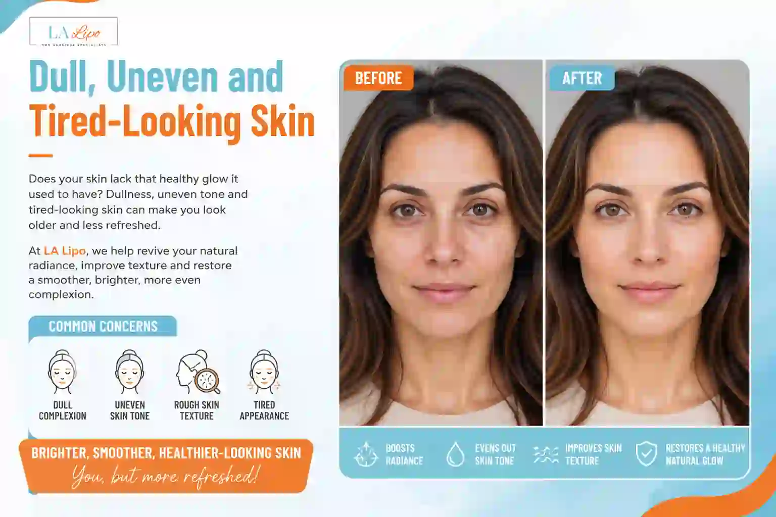 Sign #5: Dull, Uneven and Tired-Looking Skin West Brompton