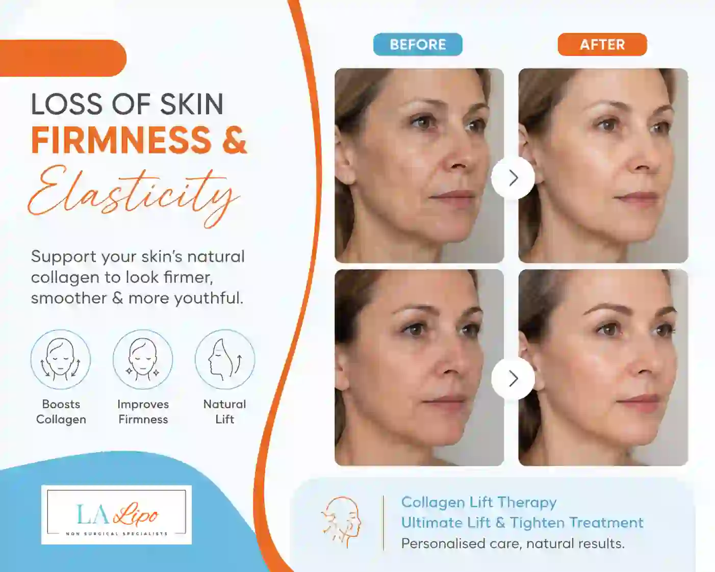 Sign #7: Loss of Skin Firmness and Elasticity West Brompton