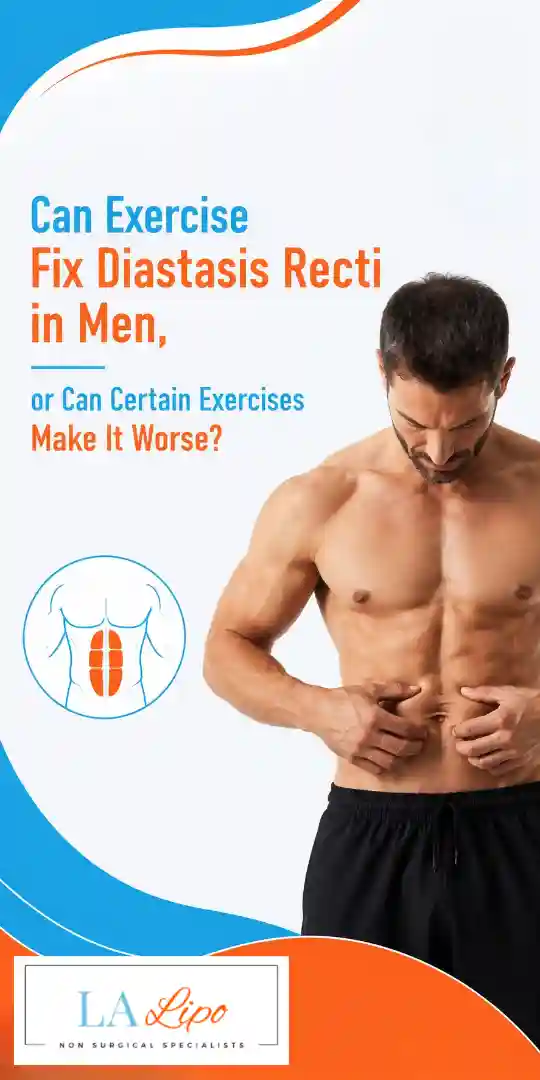 Can Exercise Fix Diastasis Recti in Men, or Can Certain Exercises Make It Worse West Brompton?