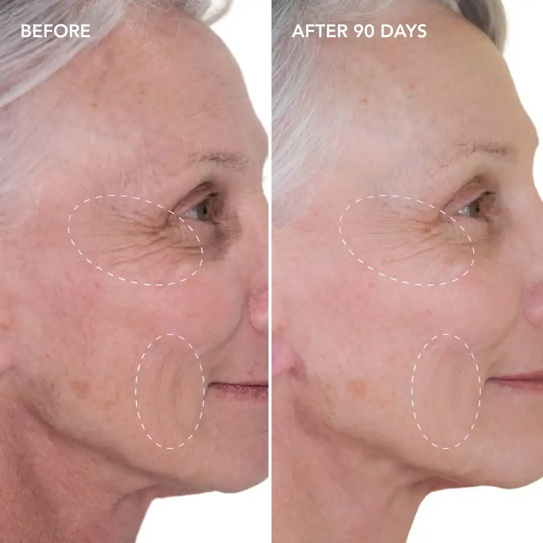 When will you see results West Brompton